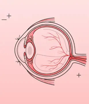 Ophthalmology Illustration Designs