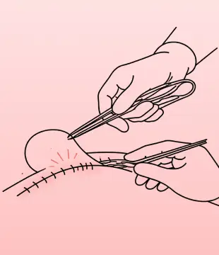 Surgical Illustration Designs