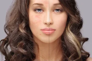 Skin Tone Enhancement